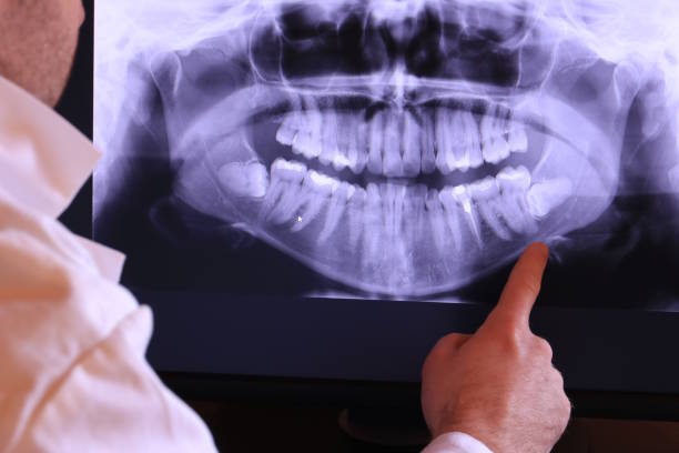Emergency Gum Pain Relief in MI