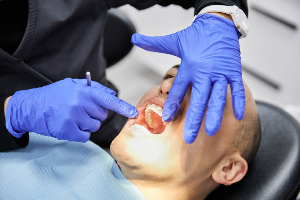 Tooth Infection Emergency Dentist in MI